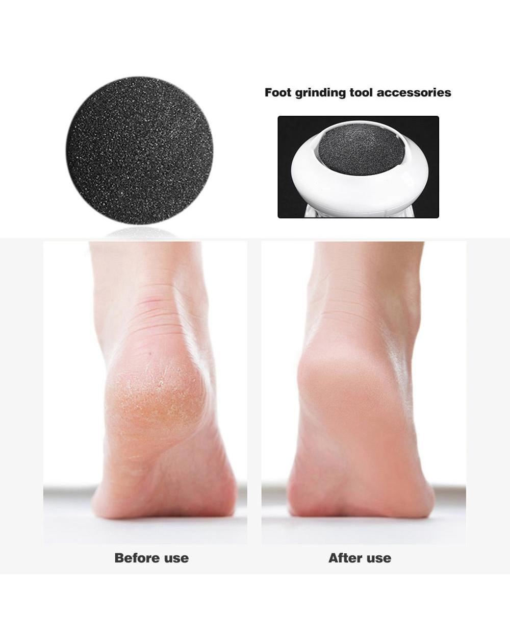 Pedicure Foot Files Clean Tools- Dead Skin Callus Remover Hard Cracked Skin Files front-4