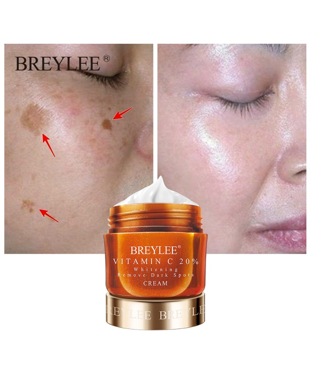 Breylee Face Cream Fade Freckle Remove Dark Spots Melanin Brightening Hyaluronic Acid Moisturizing Retinol Anti-Aging C front-0