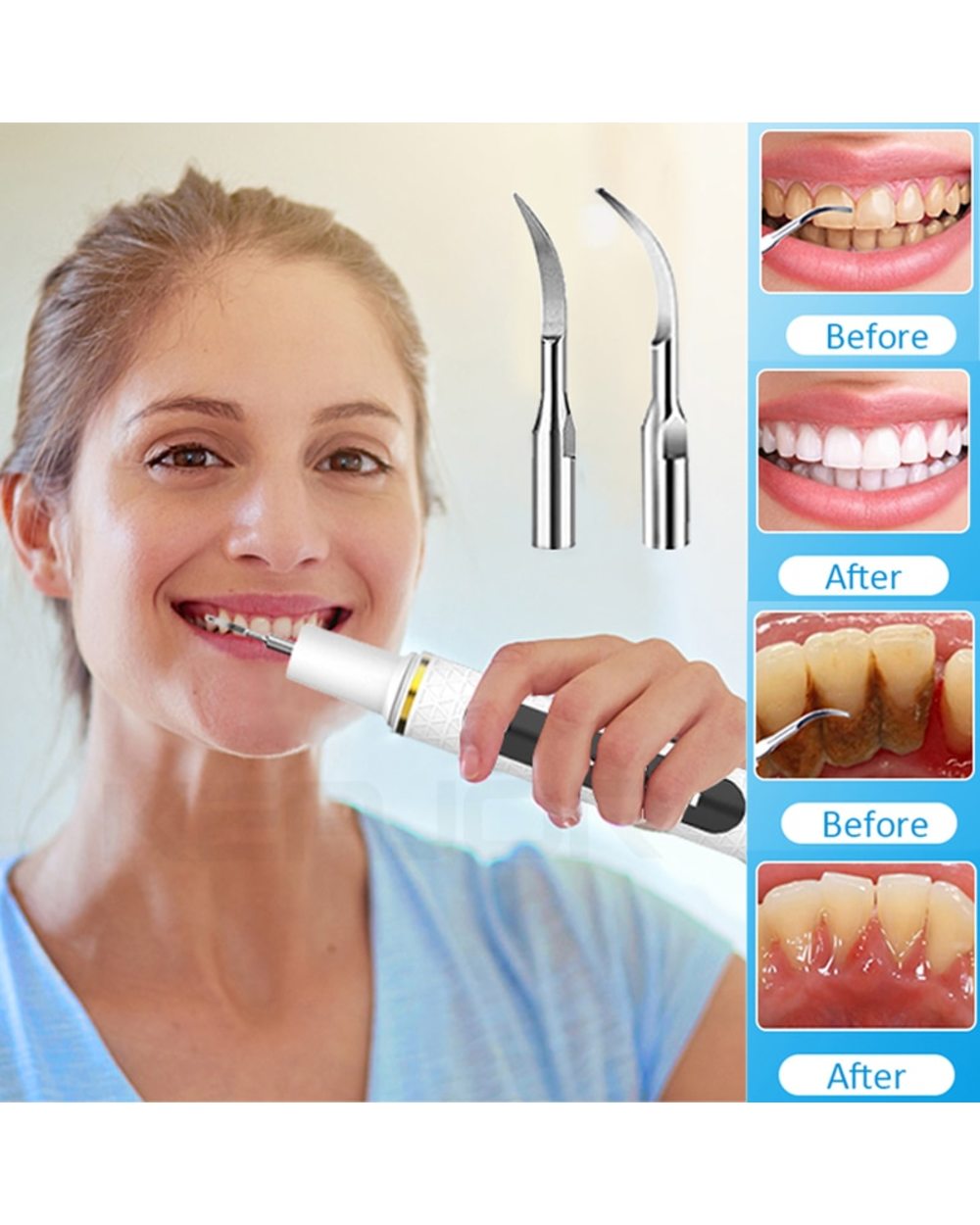 Dental Calculus Remover for Teeth Electric Tartar Plaque Cleaner