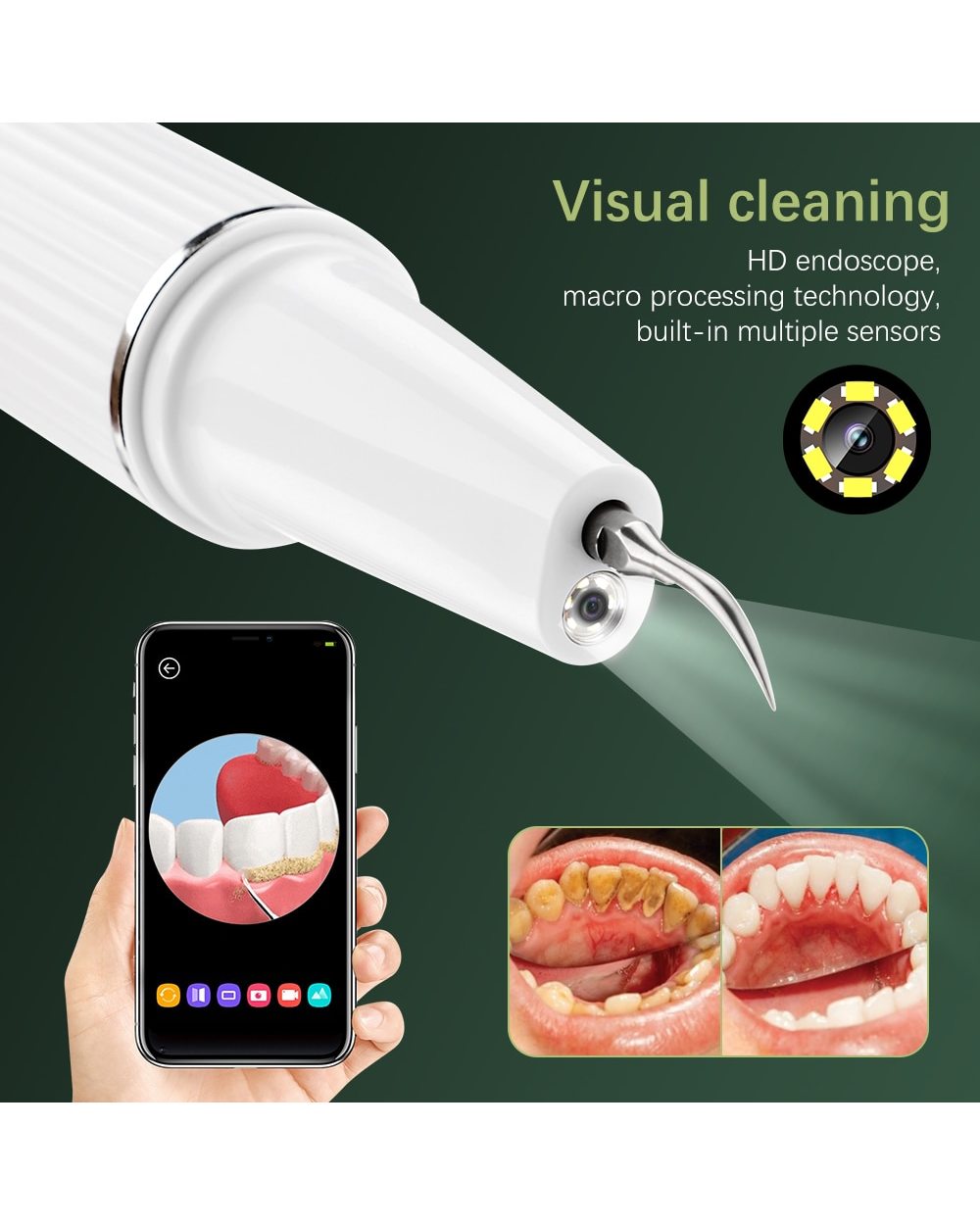 Visual Ultrasonic Dental Scaler Teeth Whitening Cleaner Dental Stone Calculus Plaque Stains Removal Tartar Scraper Oral front-3