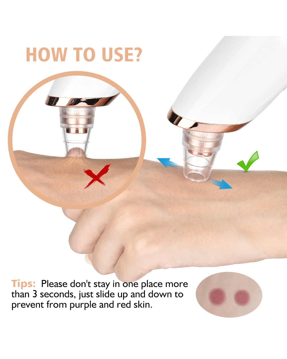 Blackhead Remover Vacuum front-3