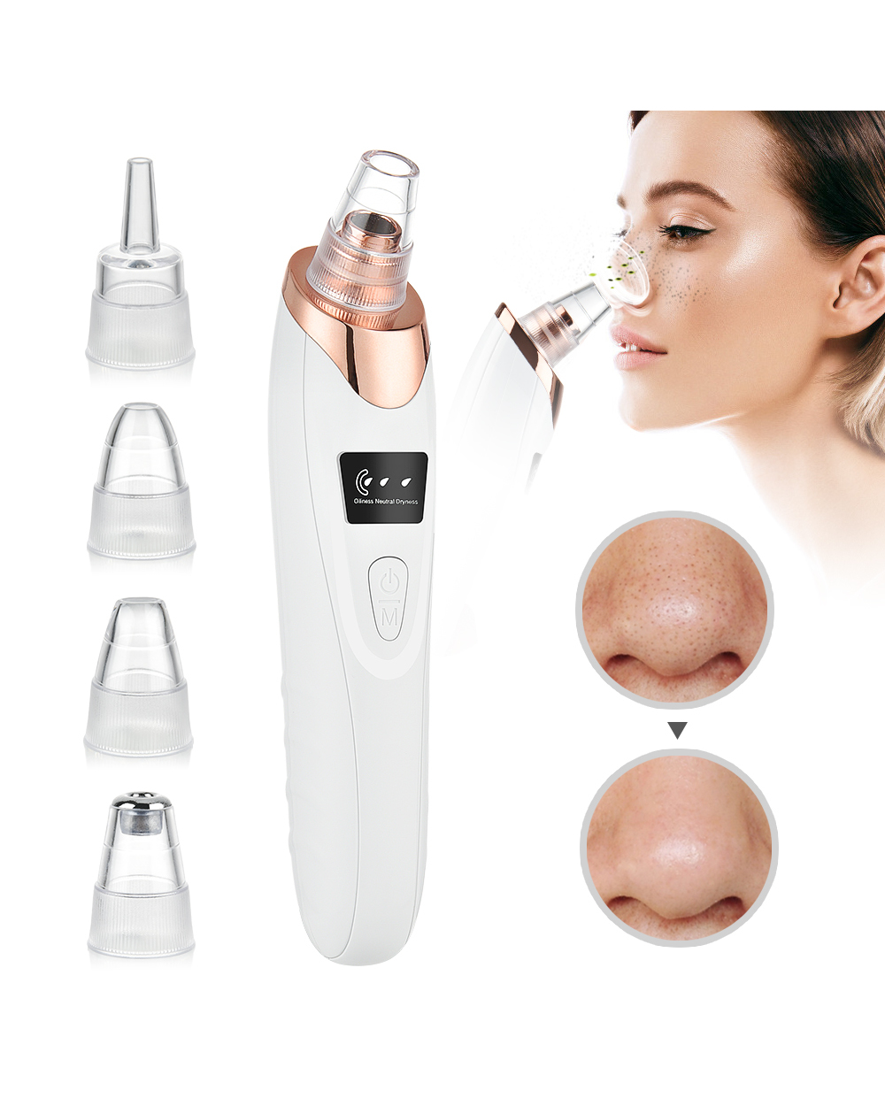 Blackhead Remover Vacuum front-1